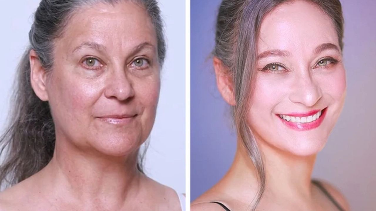 57 Yaşındaki kadın estetik ameliyatlarla 30 yaş gençleşti!