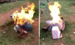 Afrika'da cadılıkla suçlanan kadın diri diri yakıldı