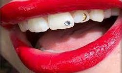 Ağız içi piercing ve diş pırlantalarının ardında yatan tehlike…