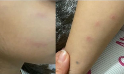 Göztepe'deki anaokulunda dehşet verici şiddet olayı: Öğretmen 5 yaşındaki öğrencisini ısırdı ve dövdü!