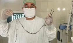 Kırgızistan'da bir kızın beynindeki kitlenin nedeni doktorları şoke etti!