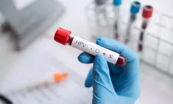 Karatay'ın HPV aşısı çıkışı yeniden gündem oldu| HPV aşısı sosyal medyayı ikiye böldü