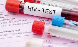 Dikkat! Avrupa HIV Testi Farkındalık Haftası'nın ikincisi başladı