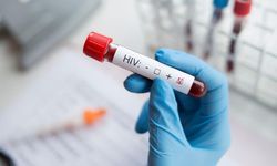 İzmir Tabip Odası'ndan çağrı: HIV bulaşan 3 hasta iddiası araştırılmalı