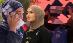 Yüzü yanan MasterChef yarışmacısı Beyza sargıyı ilk kez çıkardı! Görenler şoke oldu