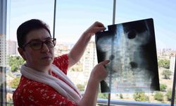 22 yıldır çıkarılamayan ameliyat iğnesi