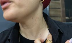 Alkollü saldırgan kadın soliste korku dolu anlar yaşattı