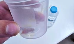Doktorlar bile şaşırdı: Bir buçuk yıldır dinmeyen öksürüğün nedeni buymuş!