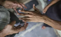 44 yıl sonra geri döndü: O nadir hastalık alarm verdi!