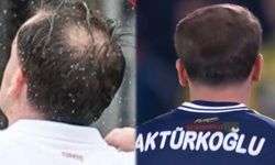 Kerem Aktürkoğlu saç mı ektirdi, saçına ne yaptı?