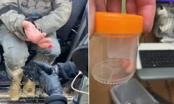 Korkunç görüntüler! Polisin parmağını ısırarak kopardı!