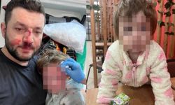 Gürültü tartışması kanlı bitti! 14 aylık bebeğin kafatası çatladı