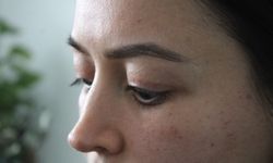 Güzellik merkezi skandalı: "Gözüm artık kapanmıyor, ameliyatı kimse üstlenmiyor!"