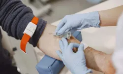 Kan tahlili orucu bozar mı? Diyanet'in resmi görüşü ne diyor?