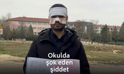 Okulda şok eden şiddet: Öğretmenden meslektaşına kaynar çaylı saldırı!