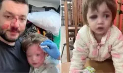 Yalova'da saldırıya uğrayan baba kız... Muhammed Baca kimdir, 14 aylık İkra bebeğin durumu nasıl?