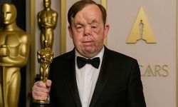 Adam Pearson kimdir, yüzüne ne oldu, hastalığı ne? İngiliz oyuncunun filmleri