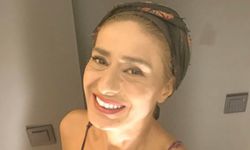 Yıldız Tilbe'nin yüzüne ne oldu? Saç boyası faciası ve estetik iddiaları gündemde