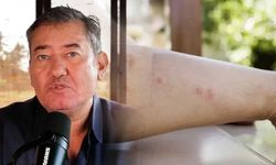 Serdar Akinan öldü mü, hastalığı ne? Ünlü gazeteci vasiyetini açıklayınca yürekler ağza geldi