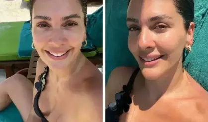 20 kilo zayıfladı... Bergüzar Korel'in tatil pozları olay oldu