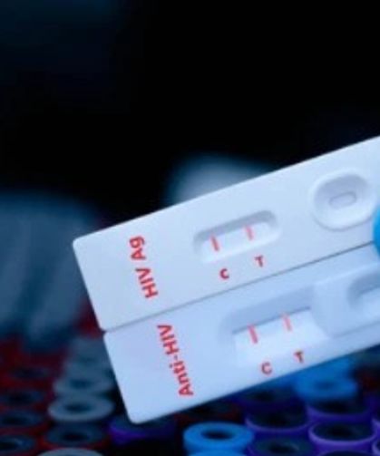 İzmir'de sağlık hamlesi: Kimliksiz, ücretsiz HIV testi başladı!