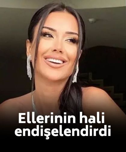 Dilan Polat'tan endişelendiren görüntüler! Ellerinin hali dikkat çekti
