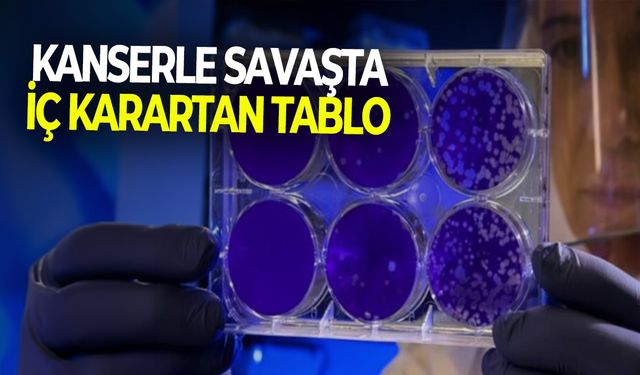 Kanserle savaşta iç karartan tablo!