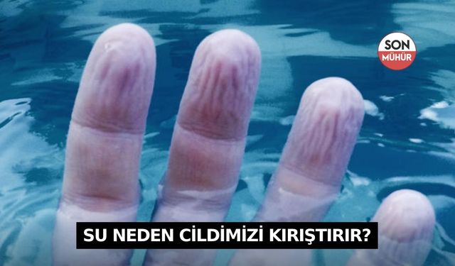 Su neden cildimizi kırıştırır?