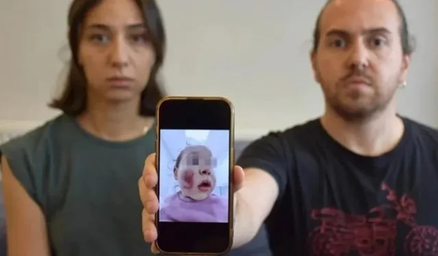 Antalya'da şoke eden kreş vahşeti: 2 yaşındaki minik bebek defalarca saldırıya uğradı