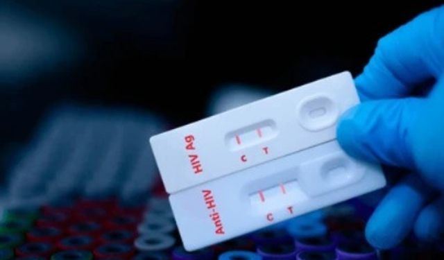 İzmir'de sağlık hamlesi: Kimliksiz, ücretsiz HIV testi başladı!
