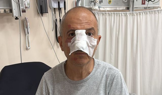 Boşanma aşamasındaki eşinin erkek kardeşi tarafından darp edildiğini iddia etti!