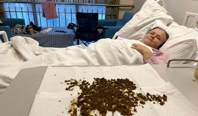 Doktorlar sayamadı, yapay zeka saydı: Safra kesesinden 20 bine yakın taş çıktı