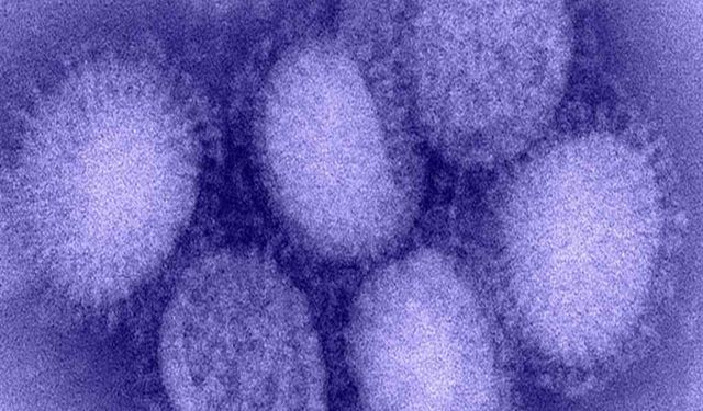 Yeni H3N2 varyantı küresel ölçekte yayılıyor: Uzmanlardan peş peşe uyarılar