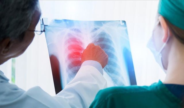 Akciğer kanserinde çevresel tehdit büyüyor: Büyükşehirlerde risk yüzde 40’a kadar artıyor
