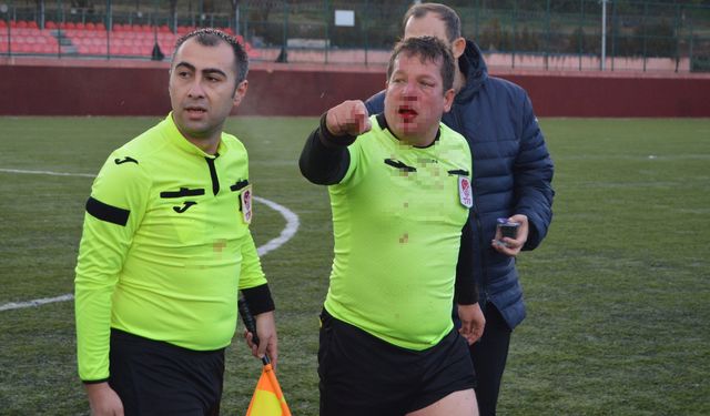 Eskişehir’de maç değil şiddet konuşuldu