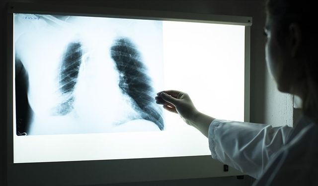 Uzm. Dr. Ömer Doğan’dan hayati verem uyarısı: "Bu belirtiler hastalığın habercisi olabilir!"