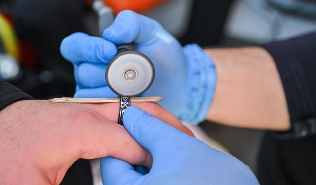 İzmir itfaiyesinde cerrahi kurtarma! Bir yüzük, bir mermi, bir hayat