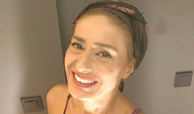 Yıldız Tilbe'nin yüzüne ne oldu? Saç boyası faciası ve estetik iddiaları gündemde