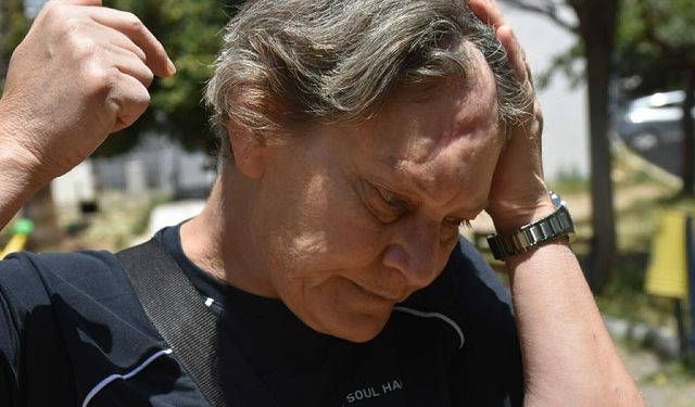 İşvereninin köpeği saldırdı, 80 dikiş atıldı!
