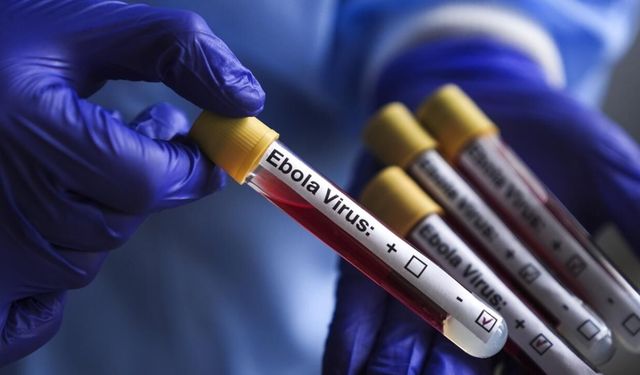 İsrail'de Ebola alarmı! Kongo'dan dönen kişi karantinaya alındı