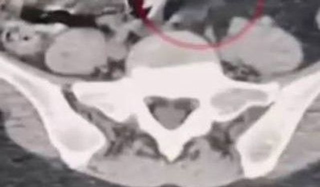 Kuryelerin makatından uyuşturucu çıktı: Narkotik polisinden film gibi operasyon!
