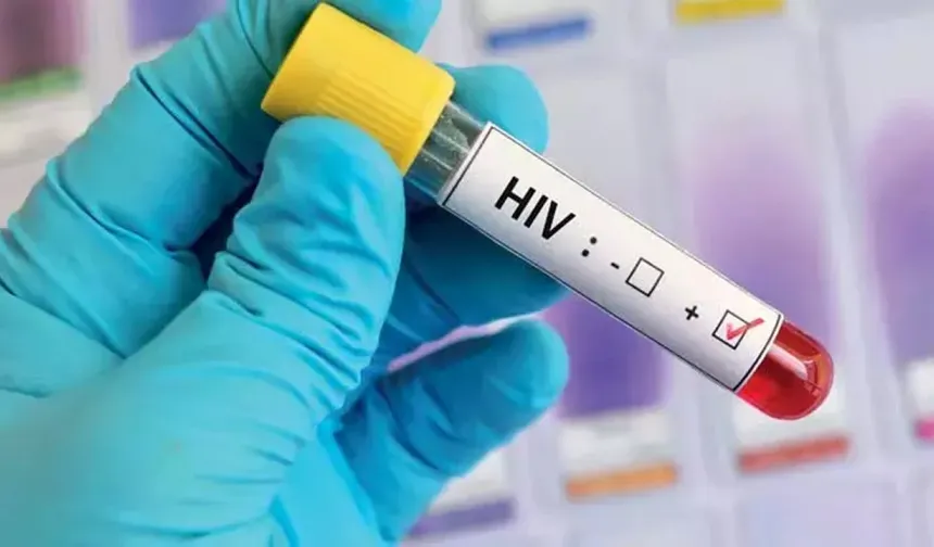 HIV tedavisinde çığır açan yöntem: Virüs beyaz kan hücrelerinde ortaya çıkıyor!