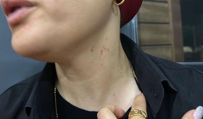 Alkollü saldırgan kadın soliste korku dolu anlar yaşattı