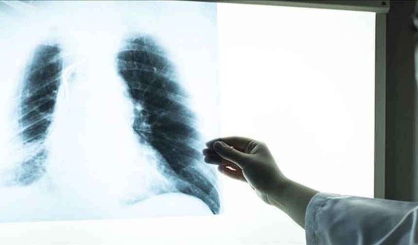 İklim değişikliği KOAH hastalarının alevlenme sıklığını artırıyor