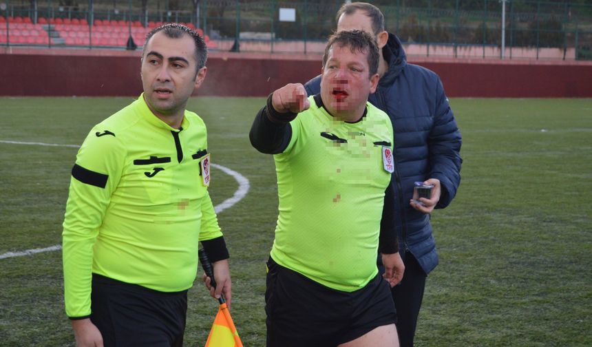 Eskişehir’de maç değil şiddet konuşuldu