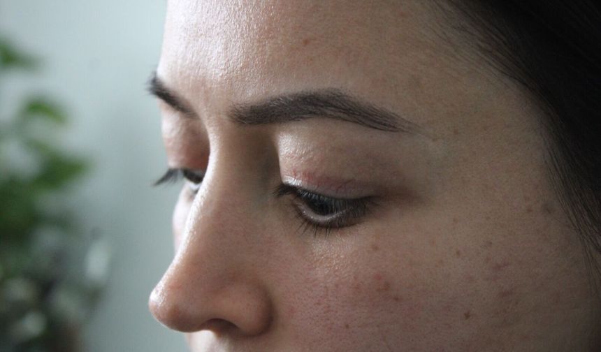 Güzellik merkezi skandalı: "Gözüm artık kapanmıyor, ameliyatı kimse üstlenmiyor!"