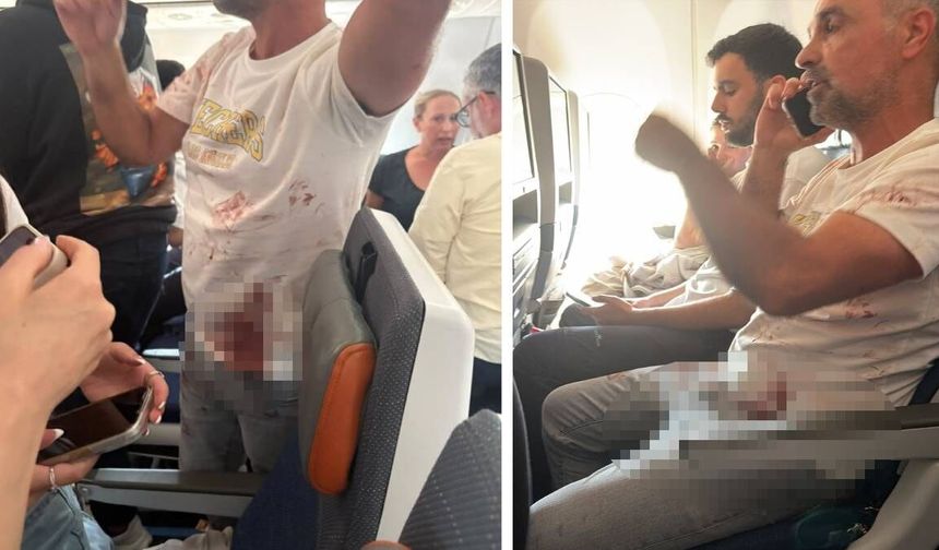 Dubai-Tel Aviv uçağıyla ilgili gerçek ortaya çıktı! İşte bıçaklanan pilot!