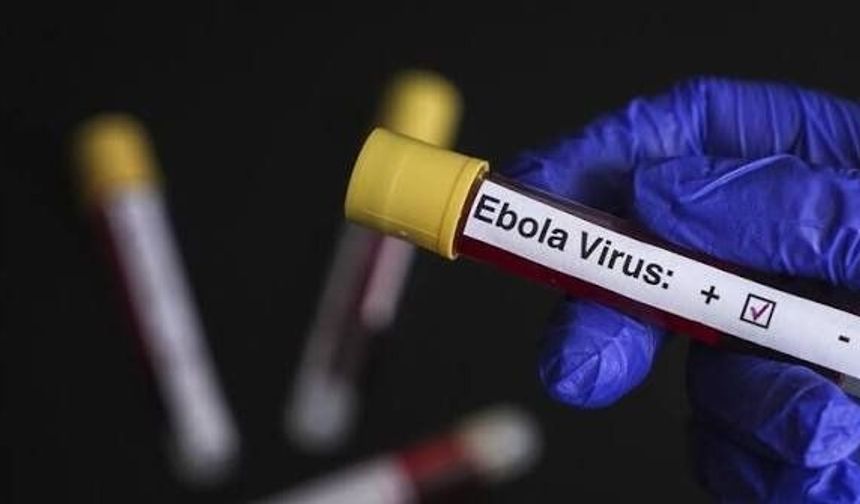 DSÖ’den Ebola görülen ülkelere seyahat ve ticaret kısıtlaması çağrısı