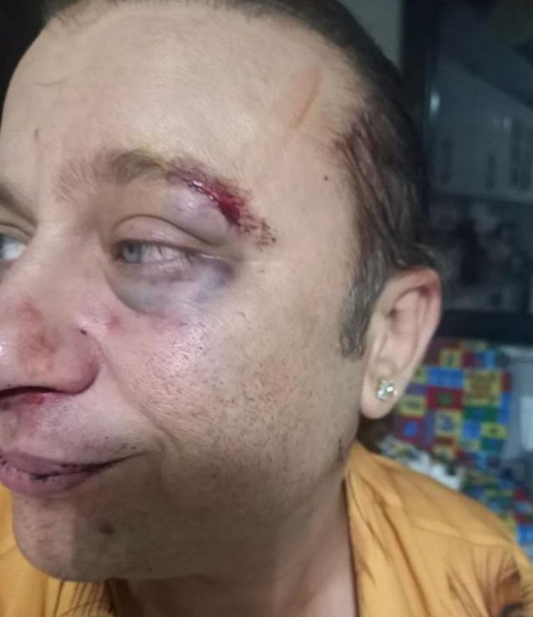 Şarkıcı Onur Akay saldırıya uğradı: Kadir Doğulu'yu masonlukla suçladı!