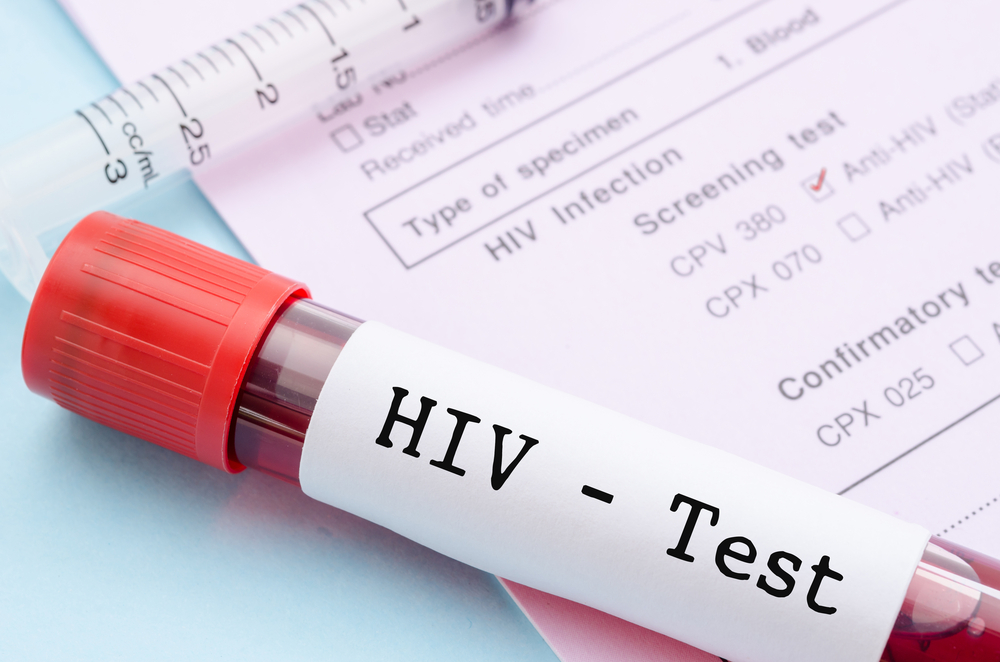 Hastalara nasıl HIV tanısı konur?